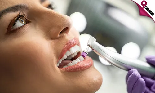Composite Tooth Filling, Scaling, Polishing & More!